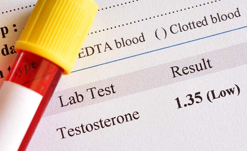 Low T levels lab test