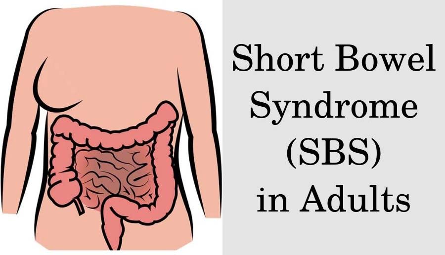 Short Bowel Syndrome in Adults