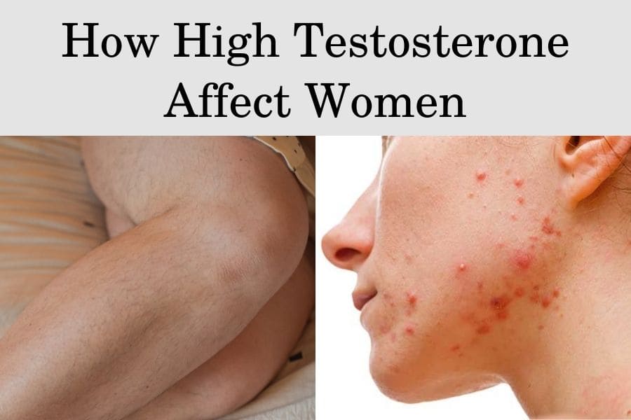 How High Testosterone Affect Women