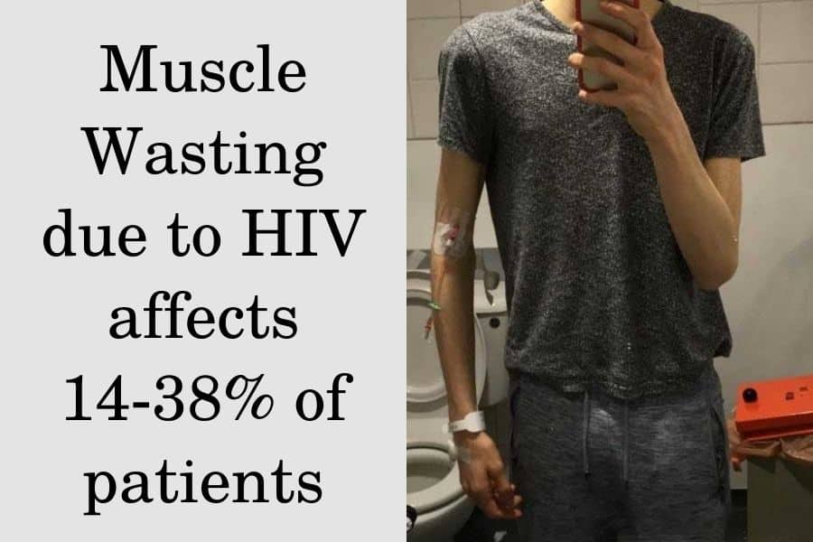 Muscle wasting due to HIV