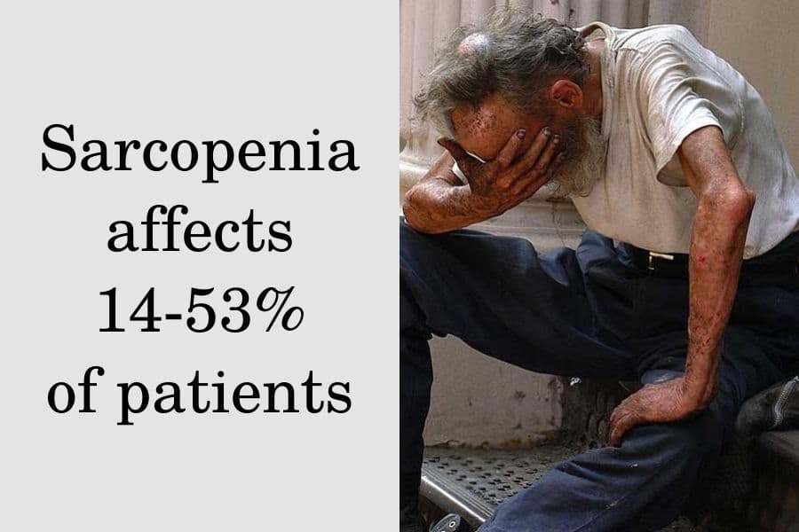 Sarcopenia in the elderly