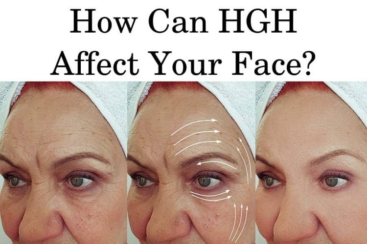 What Does Hgh Do To Your Face And Head Hfs Clinic Hgh And Trt