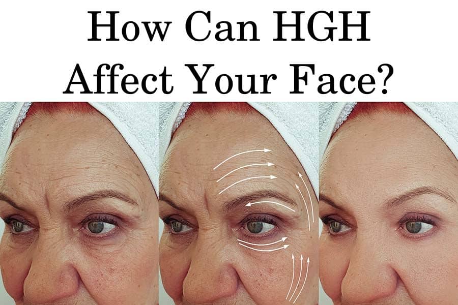 Growth Hormone Deficiency Facial Features