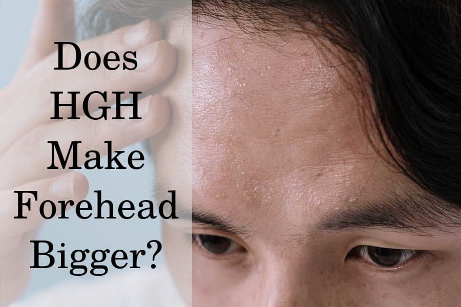 Does HGH Make Forehead Bigger?
