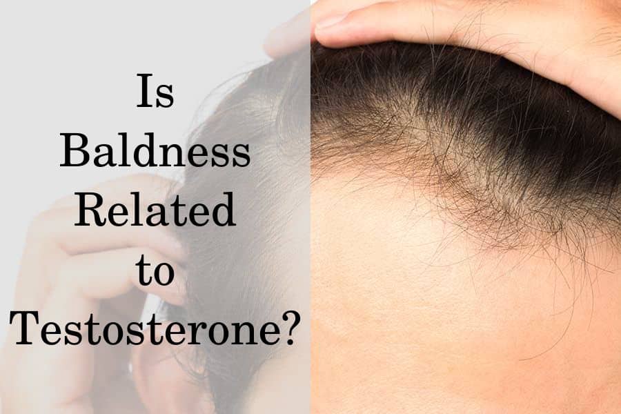 Is Baldness Related to Testosterone?