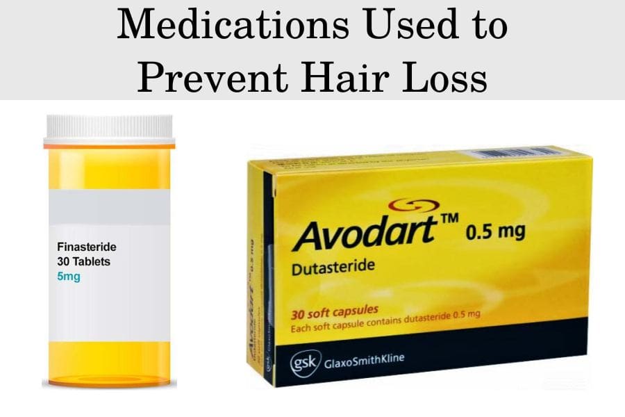 Medications Used to Prevent Hair Loss