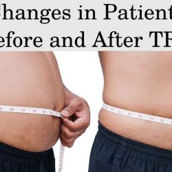 Changes in Patients Before and After TRT