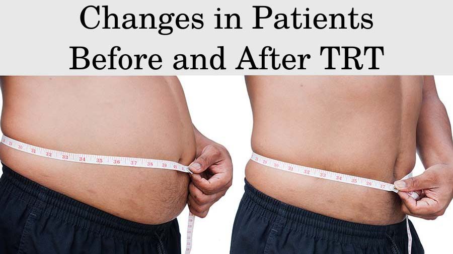 Changes in Patients Before and After TRT